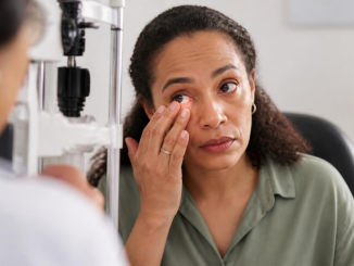 Woman with dry eye