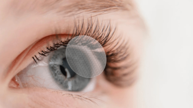 Eyeball